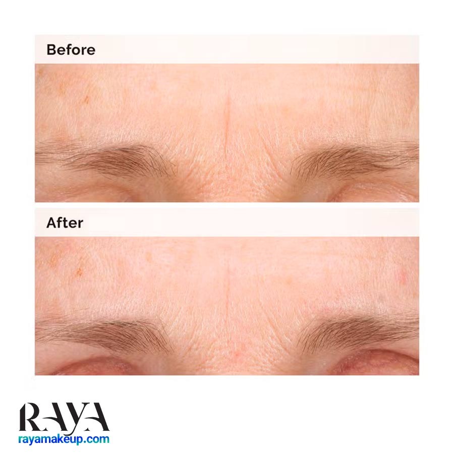 سرم امولسیون ضد پیری رتینال 0.2% اوردینری The Ordinary Retinal 0.2% Emulsion