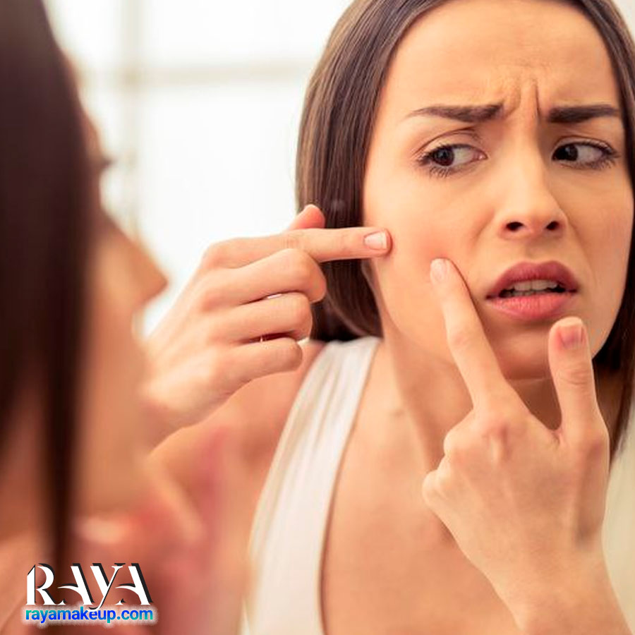 آیا می دانید بعد از جوش زدن چه کاری باید انجام داد؟
