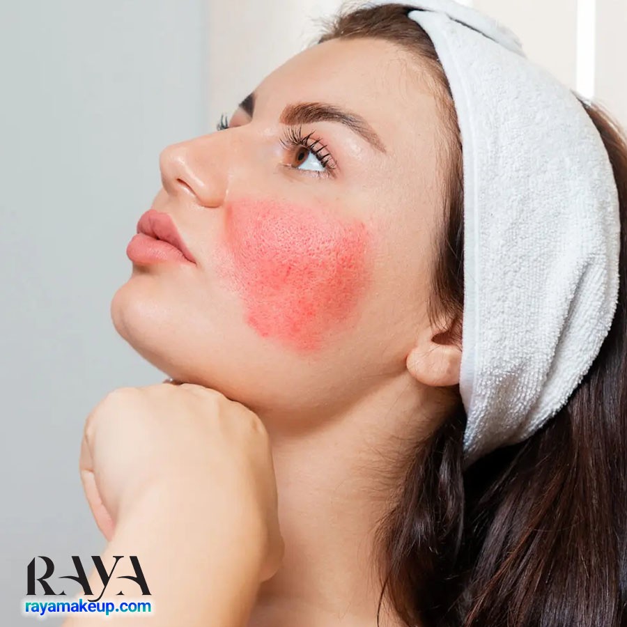 آشنایی با فواید سیتریک اسید برای پوست به همراه نحوه استفاده و عوارض جانبی آن 	