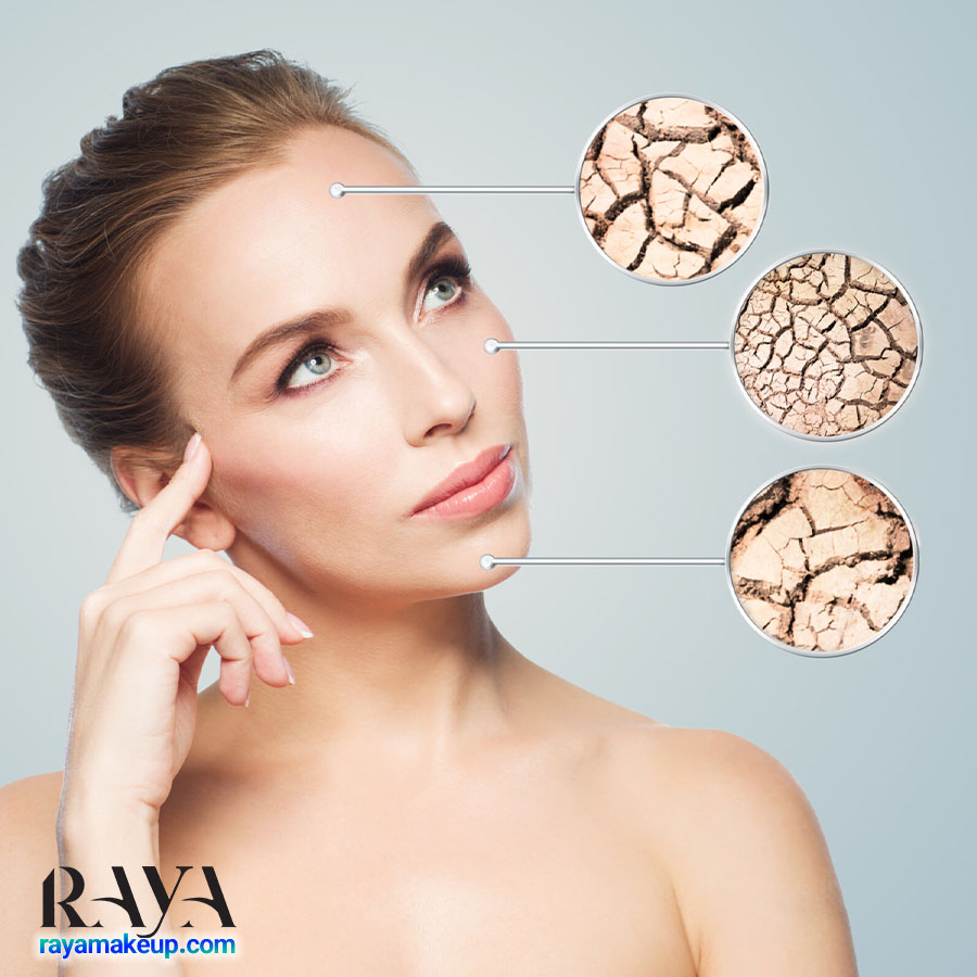 علائم آلرژی و حساسیت پوست خشک به همراه درمان موثر آن