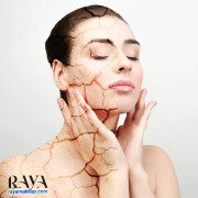 15 نکته و روش خانگی عالی برای مراقبت از پوست خشک
