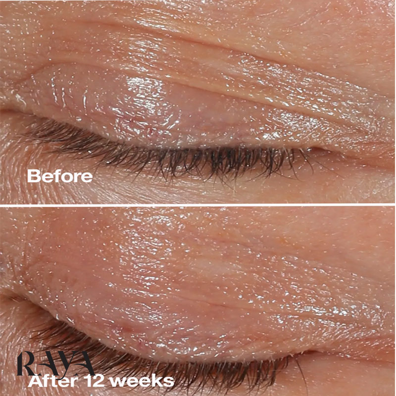 کرم ضد چروک دور چشم اسمارت کلینیک مدل کلینیکال ریپیر رینکل کارکتینگ Clinique Smart Clinical Repair Wrinkle Correcting Eye Cream