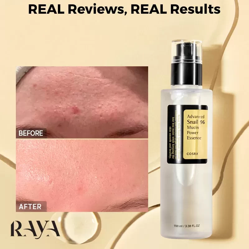 اسنس حلزون کوزارکس مدل ادونس اسنیل 96 Cosrx Advanced Snail 96 Mucin Power Essence